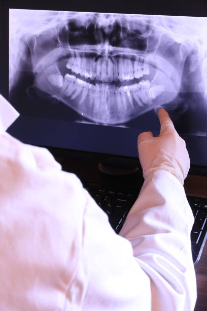 Best Emergency Tooth Extraction in Lovell, WY
