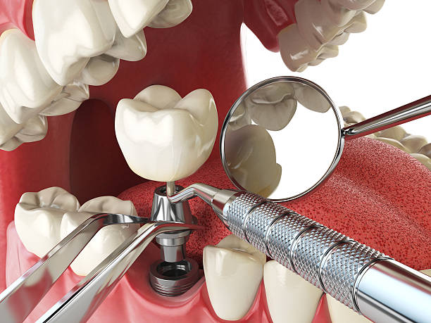 Best Emergency Treatment for Toothache in Lovell, WY